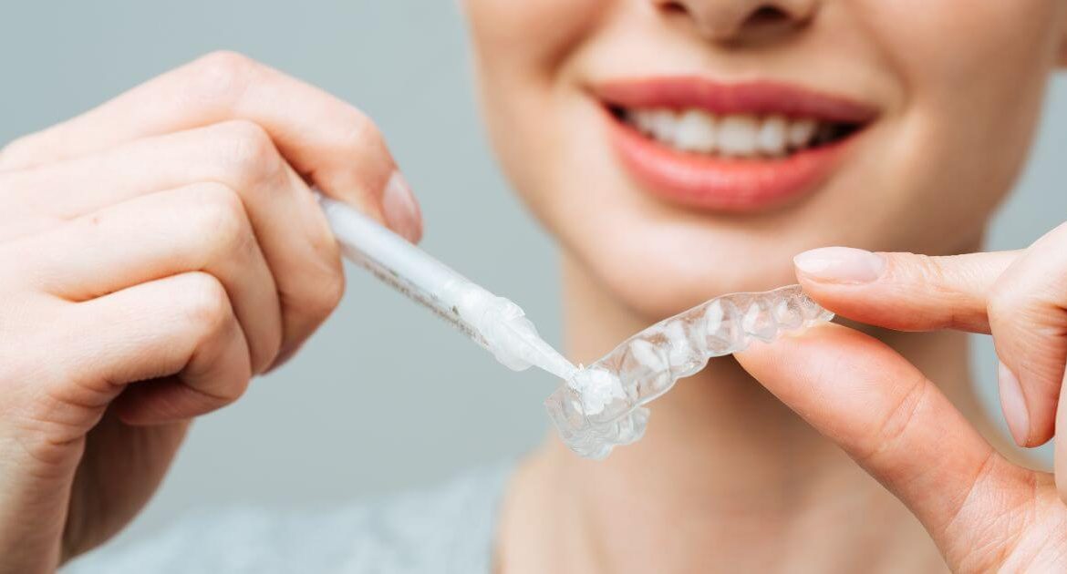 Mascherina per lo sbiancamento dei denti: come funziona