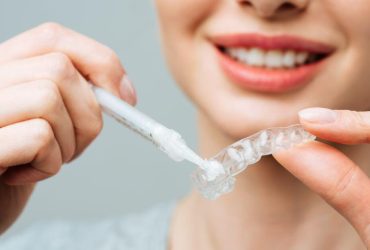 Mascherina per lo sbiancamento dei denti: come funziona