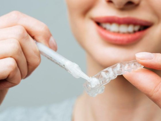 Mascherina per lo sbiancamento dei denti: come funziona