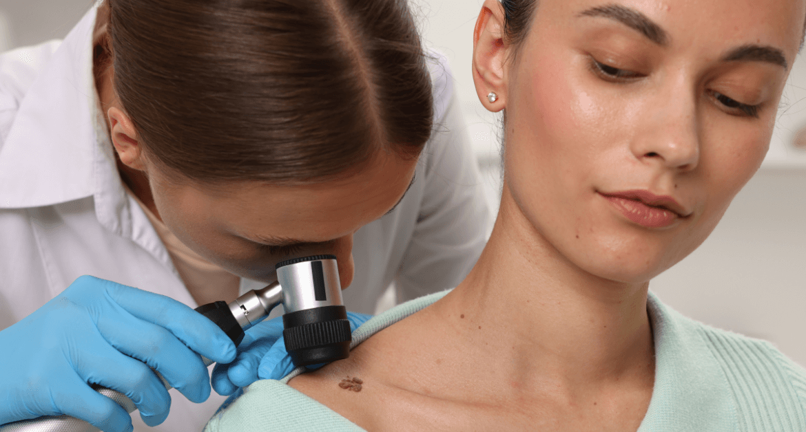 Perché un neo si infiamma? Le cause e i segnali da notare