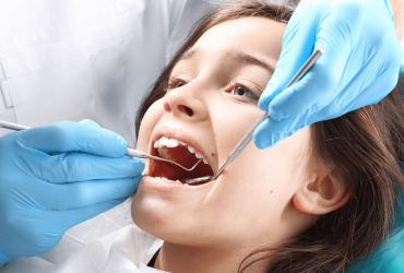 Apparecchio palatale: come funziona e quali risultati offre